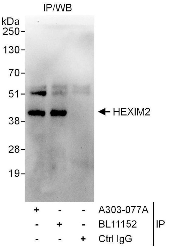HEXIM2 Antibody in Immunoprecipitation (IP)