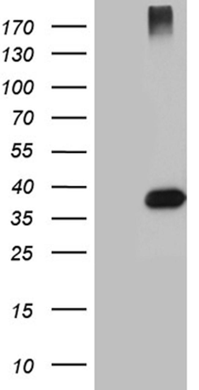 HFE2 Antibody in Western Blot (WB)