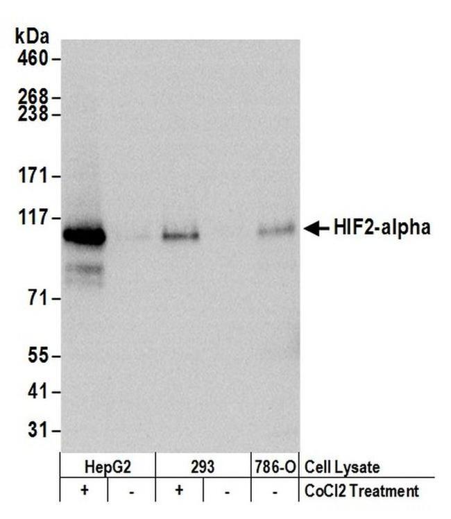 HIF2-alpha Antibody in Western Blot (WB)