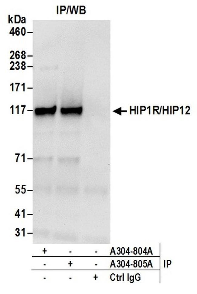 HIP1R/HIP12 Antibody in Western Blot (WB)