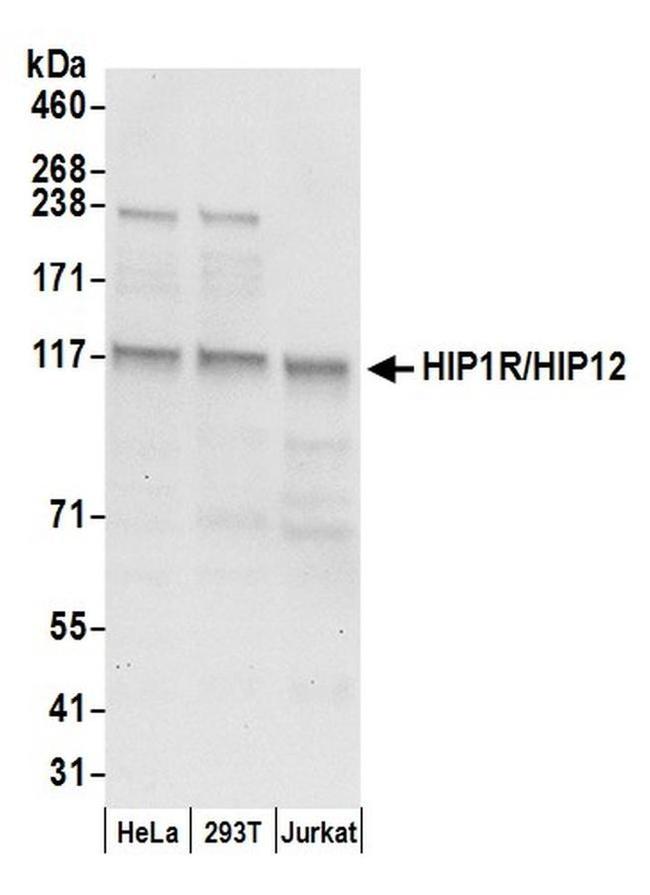 HIP1R/HIP12 Antibody in Western Blot (WB)