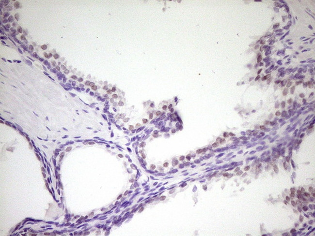 HIPK1 Antibody in Immunohistochemistry (Paraffin) (IHC (P))