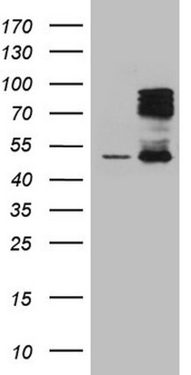 HIPK1 Antibody in Western Blot (WB)