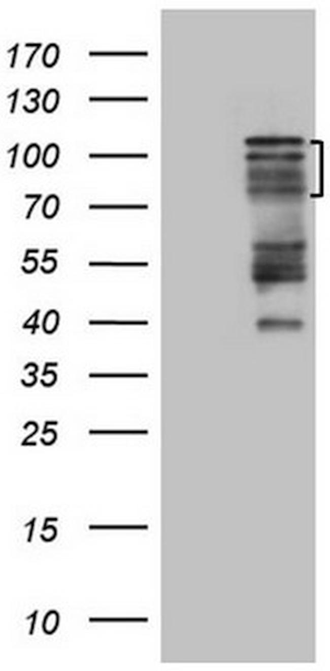 HIPK1 Antibody in Western Blot (WB)