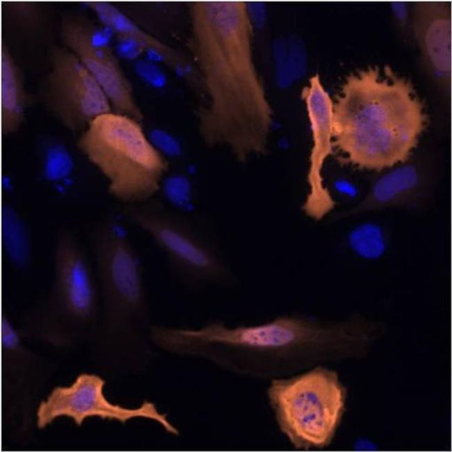 https://www.thermofisher.com/antibody/images/650/HIS(E3)-A555-Antibody-MA1-135-A555-IF-120160323131146.jpg?time=20220826?time=20220826