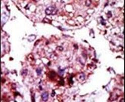 HK1 Antibody in Immunohistochemistry (IHC)