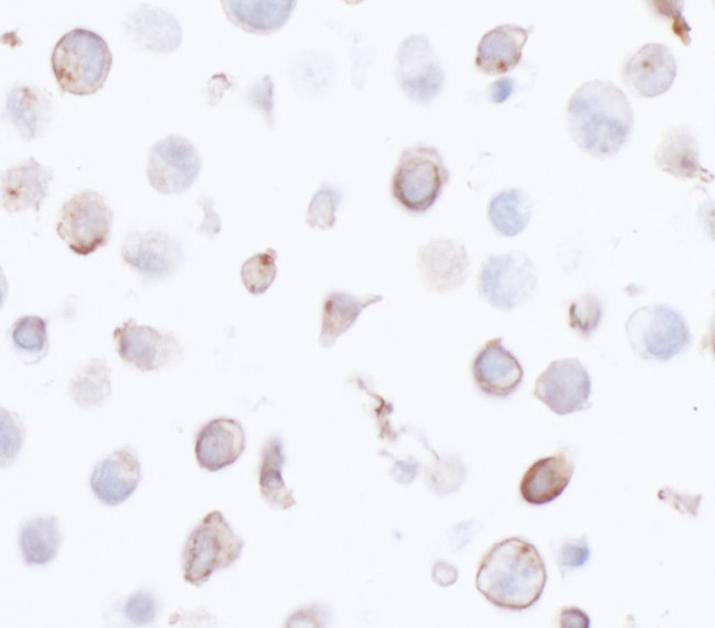 HLA-DR Antibody in Immunocytochemistry (ICC/IF)