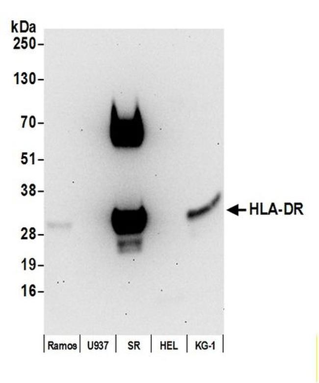 HLA-DR Antibody in Western Blot (WB)