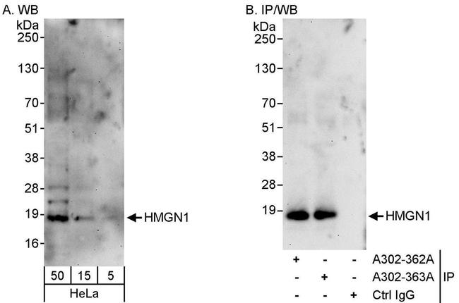 HMGN1 Antibody in Western Blot (WB)