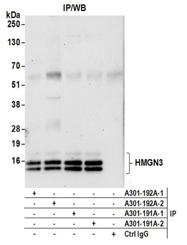 HMGN3 Antibody in Western Blot (WB)