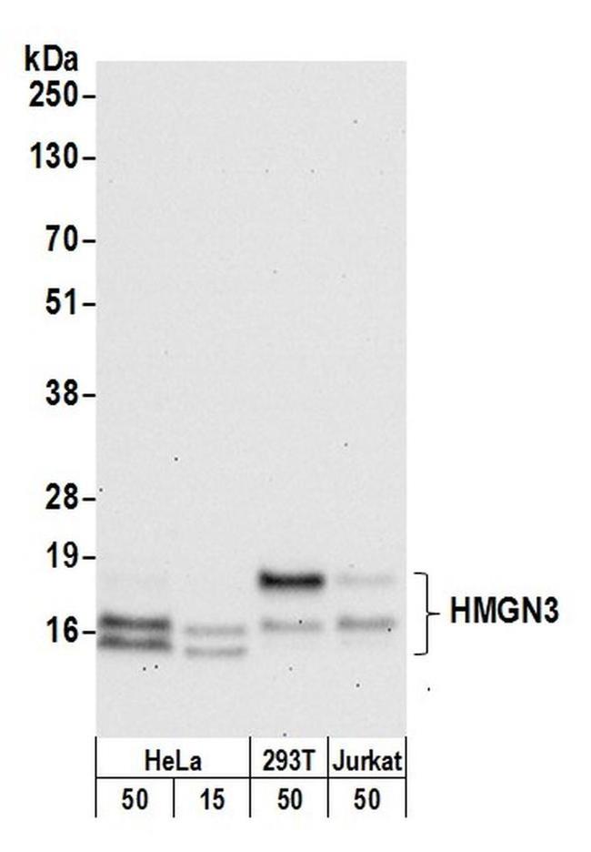 HMGN3 Antibody in Western Blot (WB)