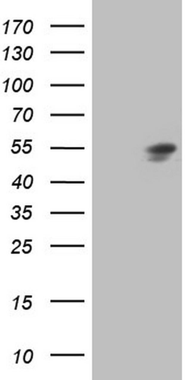 HNF4A Antibody in Western Blot (WB)