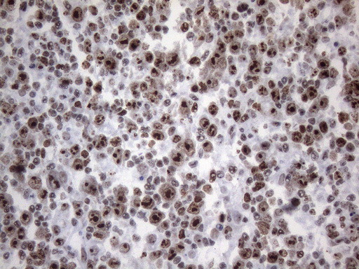 HNRNPA0 Antibody in Immunohistochemistry (Paraffin) (IHC (P))