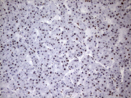 HNRNPA0 Antibody in Immunohistochemistry (Paraffin) (IHC (P))