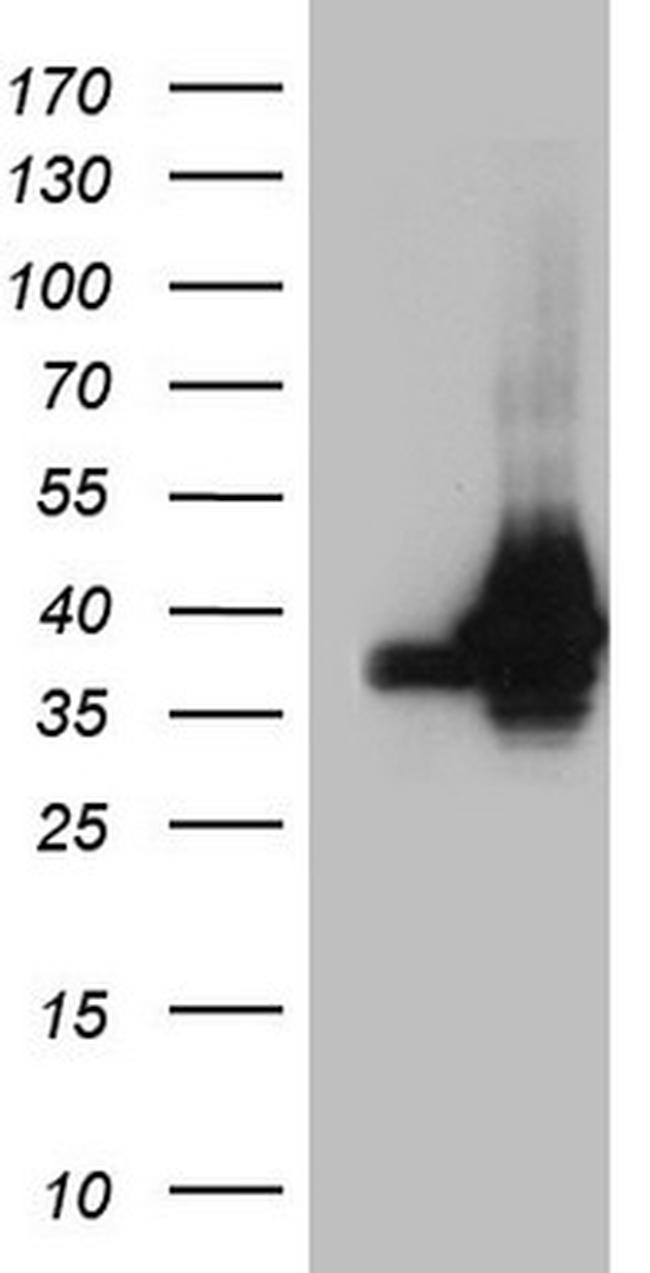 HNRNPA0 Antibody in Western Blot (WB)