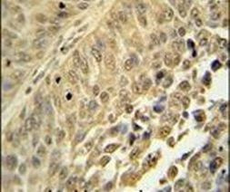 hnRNP C Antibody in Immunohistochemistry (IHC)