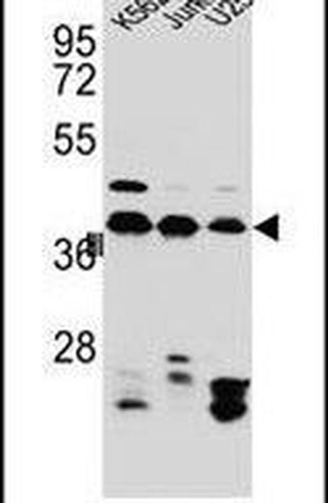 hnRNP C Antibody in Western Blot (WB)