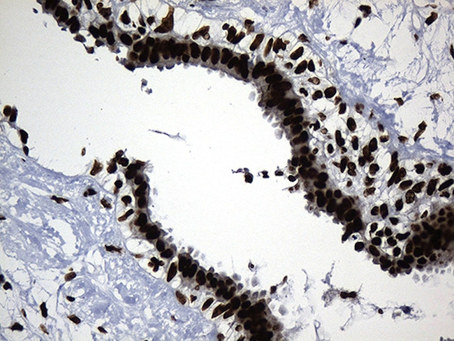 HNRNPH1 Antibody in Immunohistochemistry (Paraffin) (IHC (P))