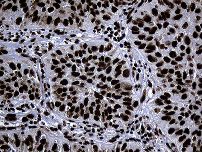 HNRNPH1 Antibody in Immunohistochemistry (Paraffin) (IHC (P))