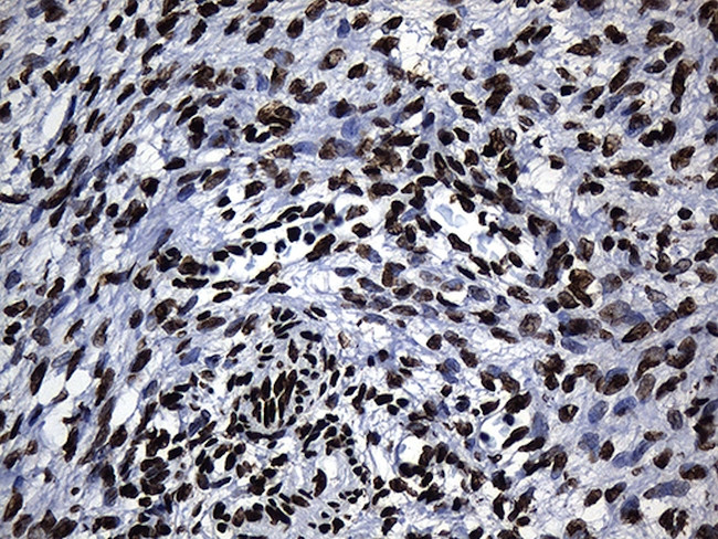 HNRNPH1 Antibody in Immunohistochemistry (Paraffin) (IHC (P))