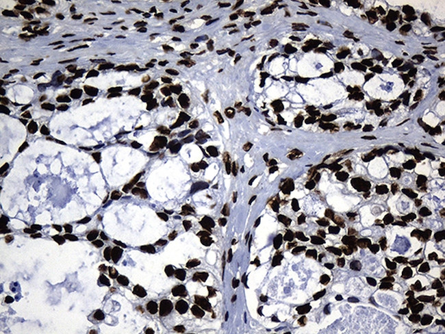 HNRNPH1 Antibody in Immunohistochemistry (Paraffin) (IHC (P))