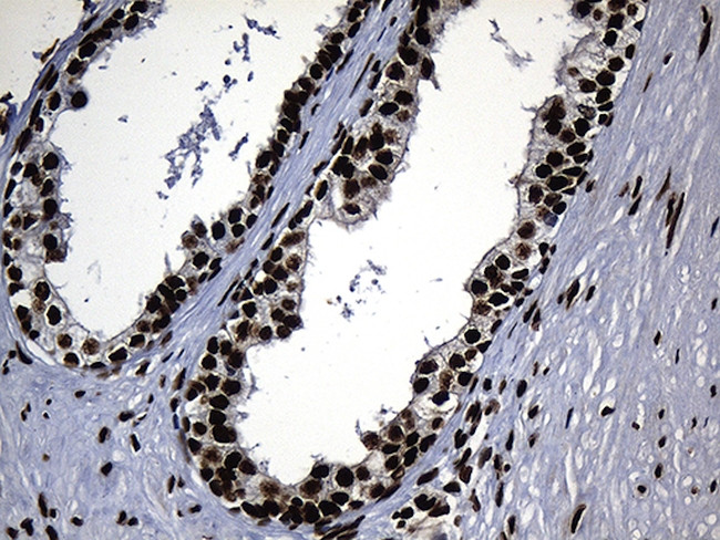 HNRNPH1 Antibody in Immunohistochemistry (Paraffin) (IHC (P))