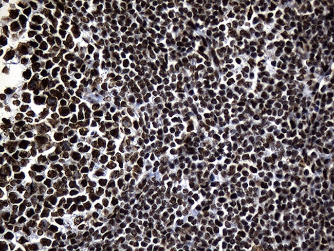 HNRNPH1 Antibody in Immunohistochemistry (Paraffin) (IHC (P))