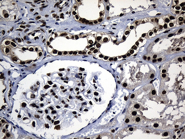 HNRNPH1 Antibody in Immunohistochemistry (Paraffin) (IHC (P))