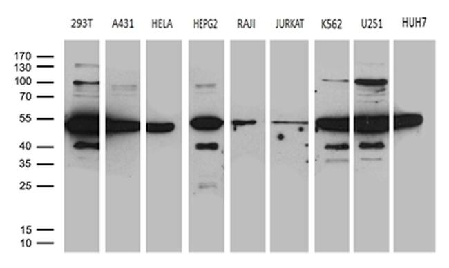 HNRNPH1 Antibody in Western Blot (WB)