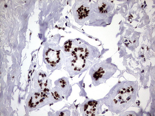 HNRNPM Antibody in Immunohistochemistry (Paraffin) (IHC (P))