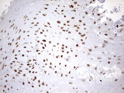 HNRNPM Antibody in Immunohistochemistry (Paraffin) (IHC (P))