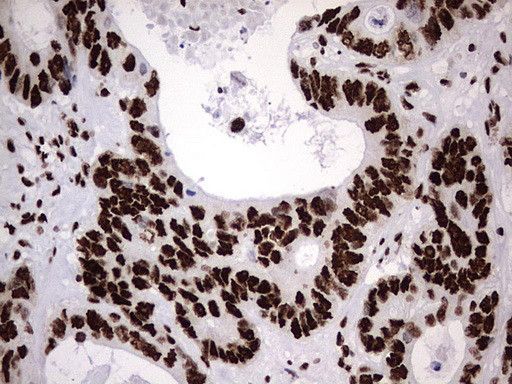 HNRNPM Antibody in Immunohistochemistry (Paraffin) (IHC (P))