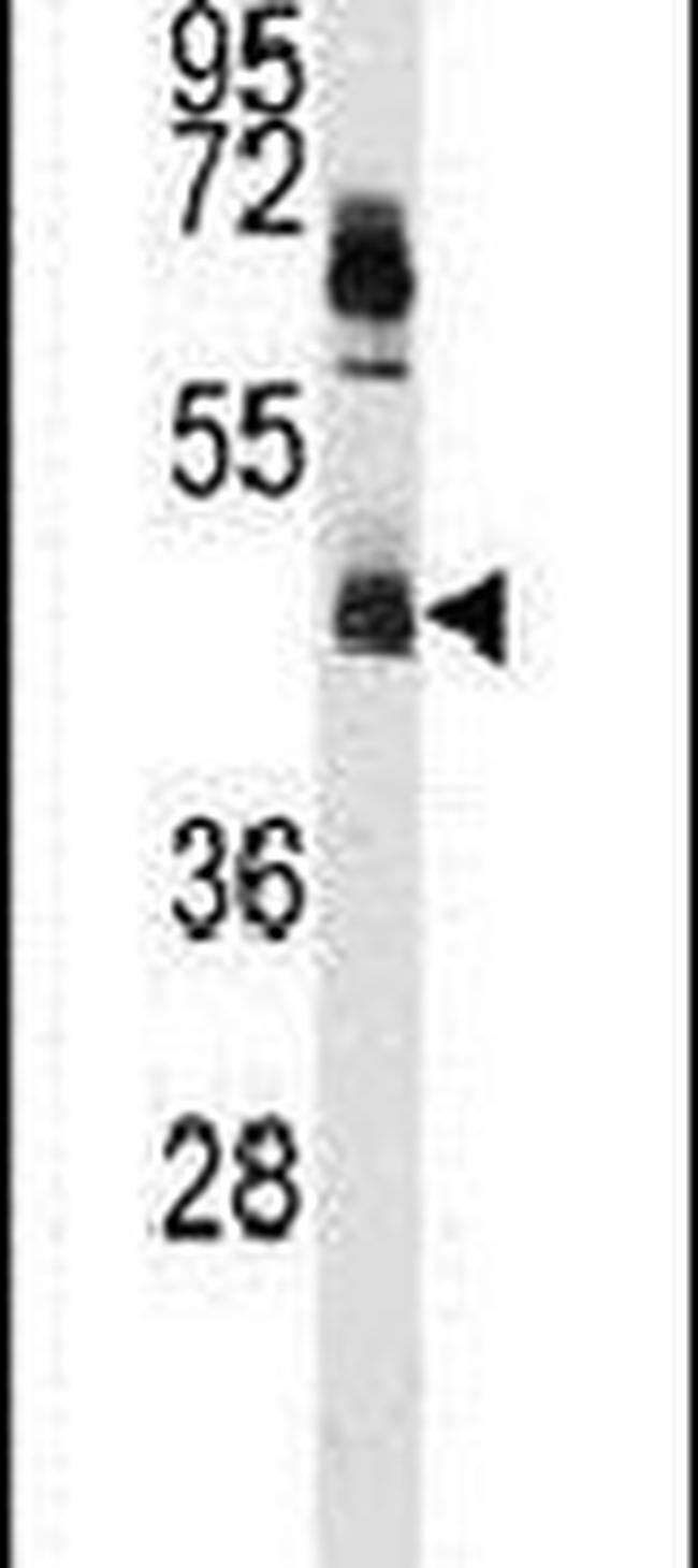 hnRNP K Antibody in Western Blot (WB)