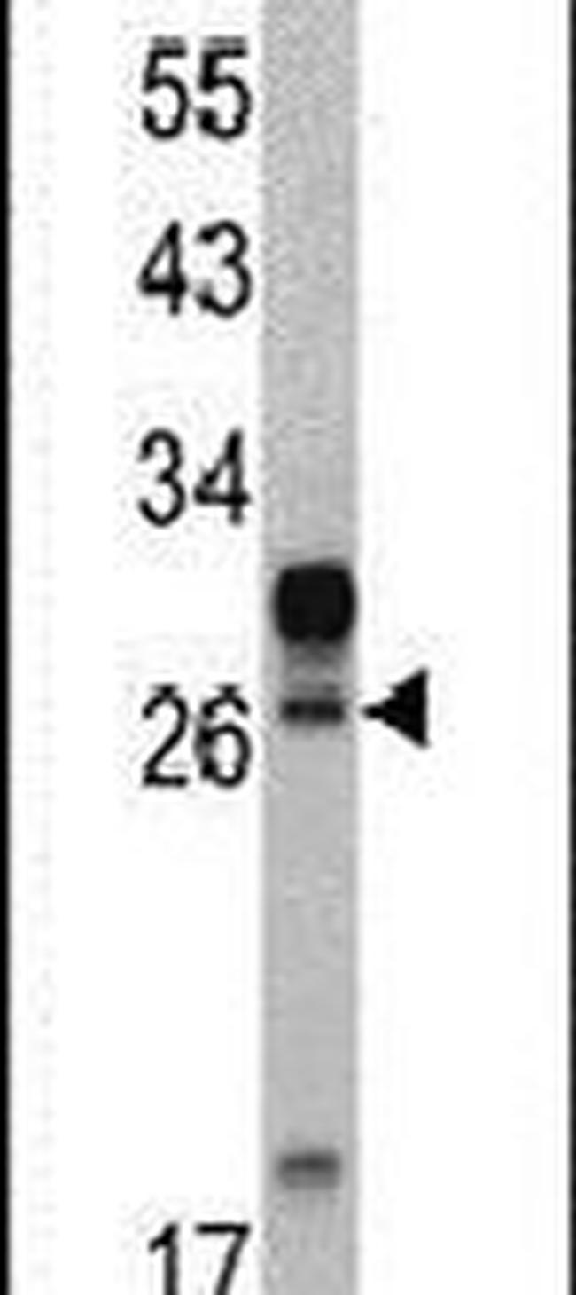 HOXA5 Antibody in Western Blot (WB)