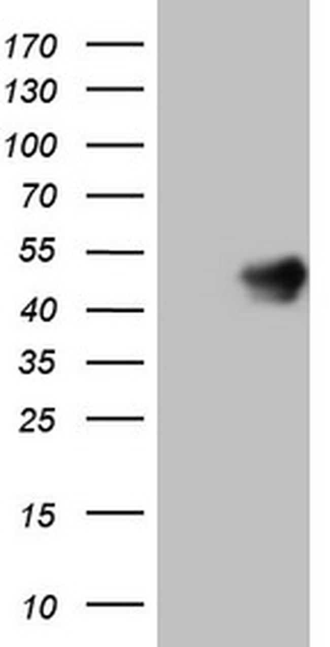 HOXC10 Antibody in Western Blot (WB)