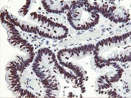 HOXC11 Antibody in Immunohistochemistry (Paraffin) (IHC (P))