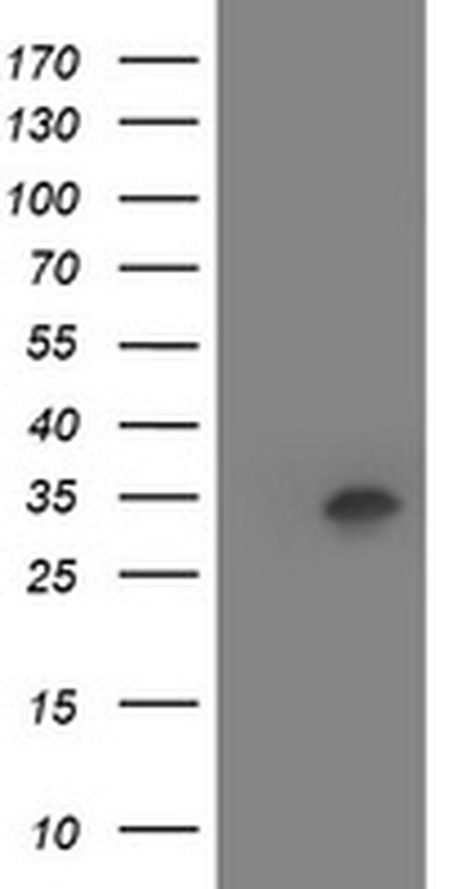 HOXC11 Antibody in Western Blot (WB)