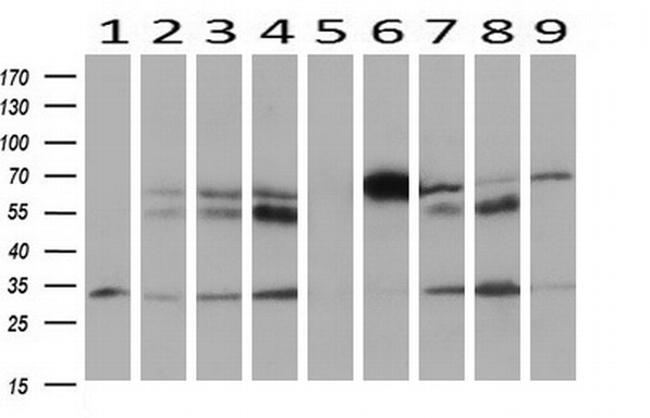 HOXC11 Antibody in Western Blot (WB)