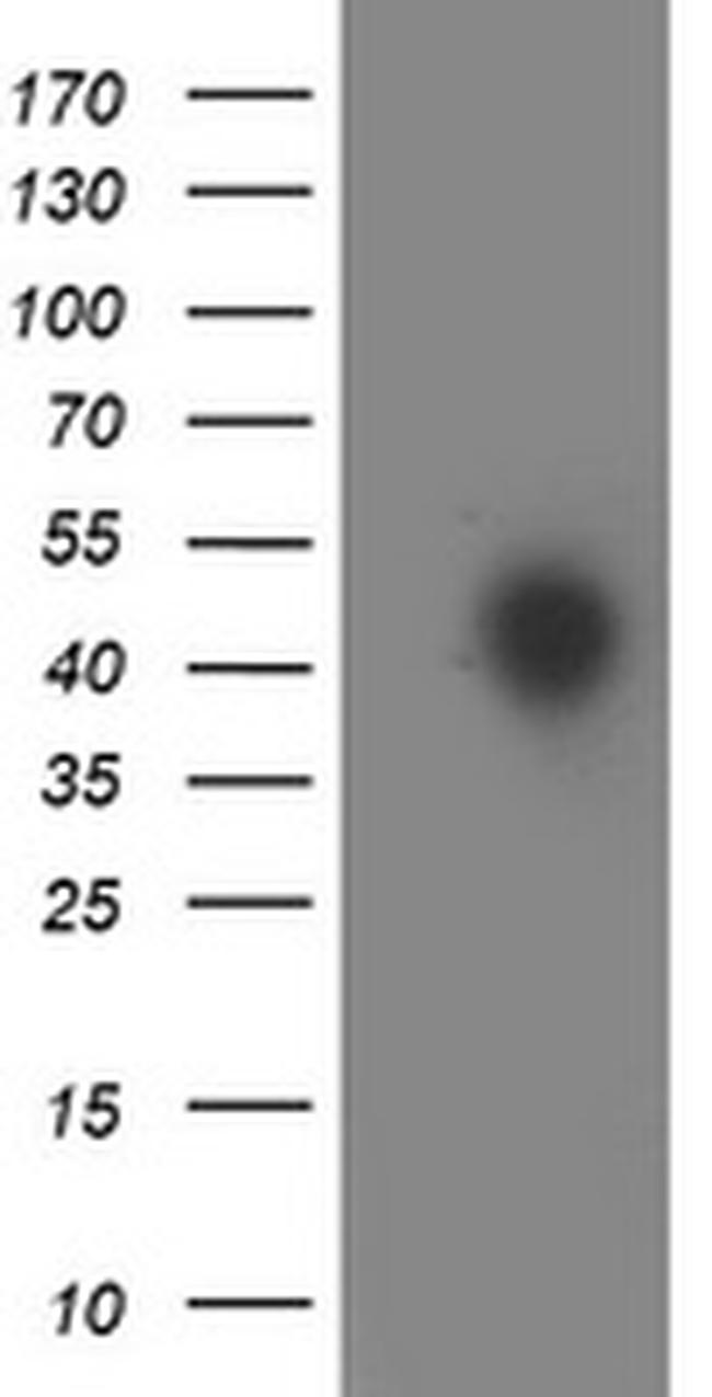 HOXC11 Antibody in Western Blot (WB)