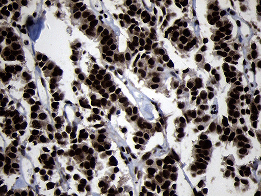 HOXC4 Antibody in Immunohistochemistry (Paraffin) (IHC (P))