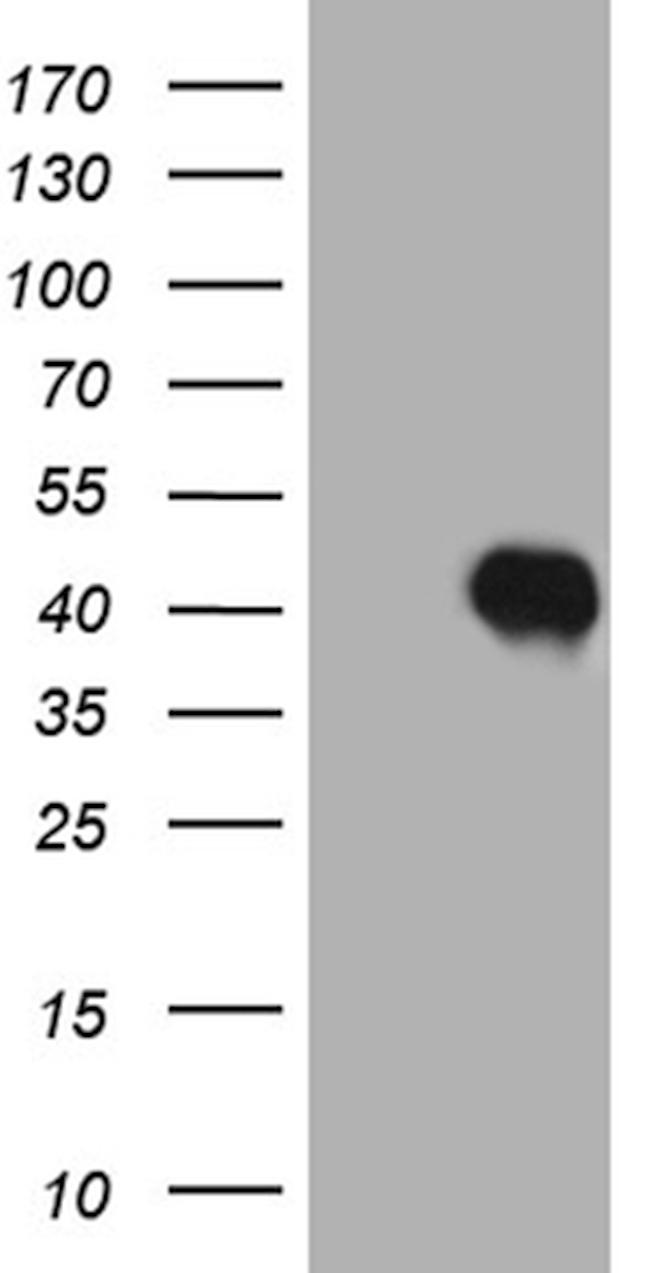 HOXC4 Antibody in Western Blot (WB)