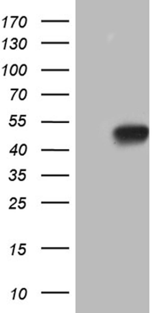 HOXC4 Antibody in Western Blot (WB)