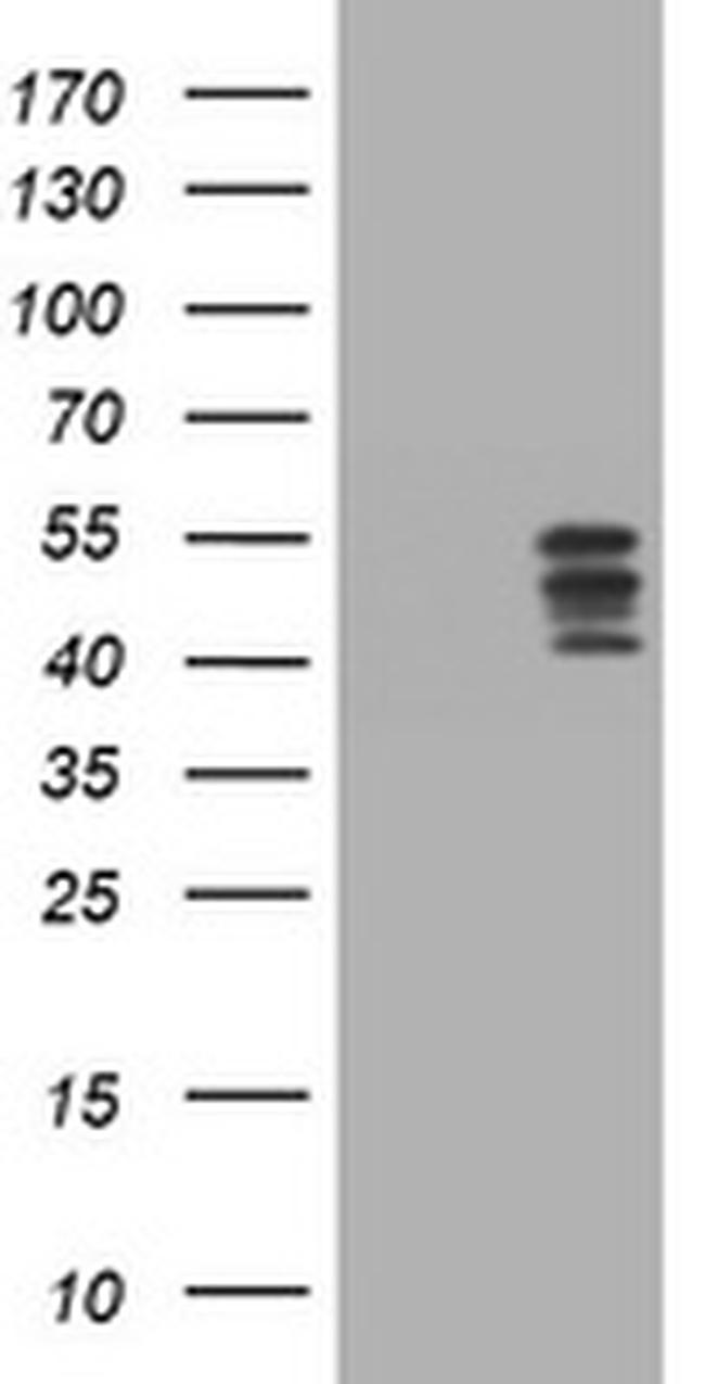 HOXD10 Antibody in Western Blot (WB)