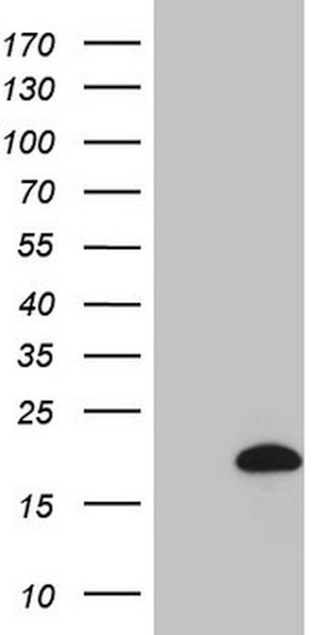 HPCAL4 Antibody in Western Blot (WB)