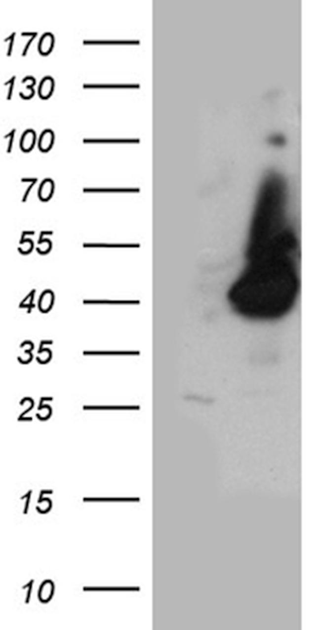 HPR Antibody in Western Blot (WB)