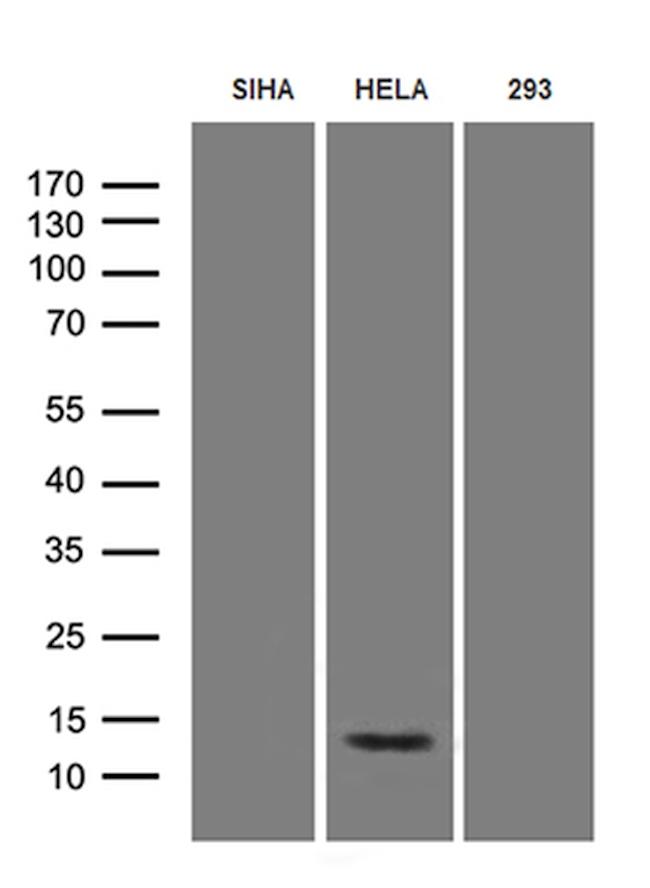 HPV18 E7 Antibody in Western Blot (WB)