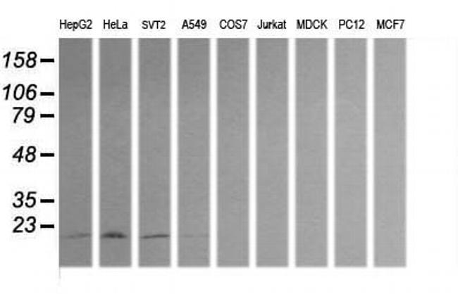 HRAS Antibody in Western Blot (WB)