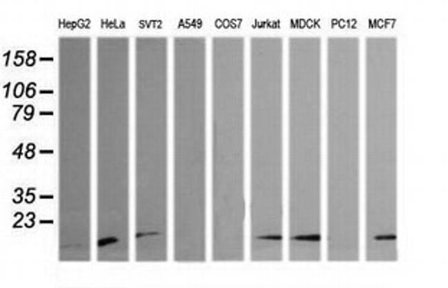 HRAS Antibody in Western Blot (WB)