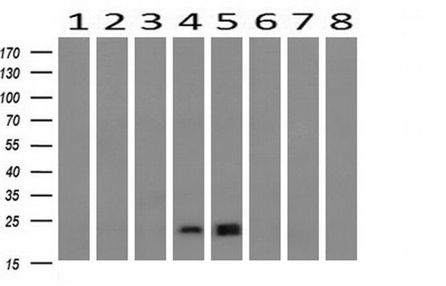 HRAS Antibody in Western Blot (WB)