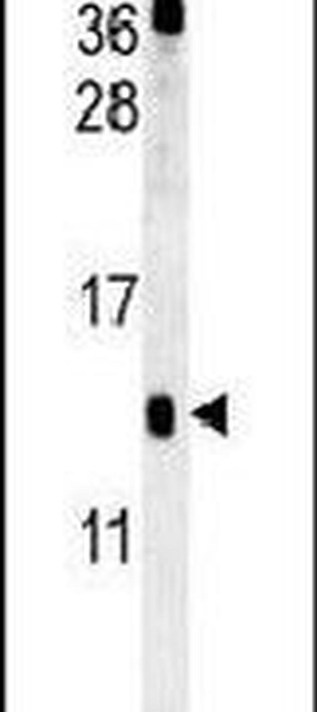 HRASLS3 Antibody in Western Blot (WB)